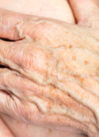 揭秘老年斑的真相！營養、護理與防曬的秘訣大公開