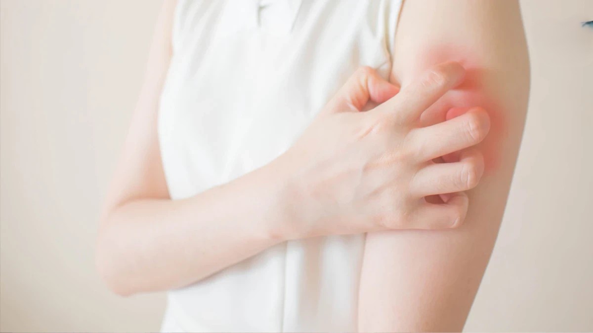 好不了的濕疹？乾癬？小心是罕見皮膚T細胞淋巴瘤