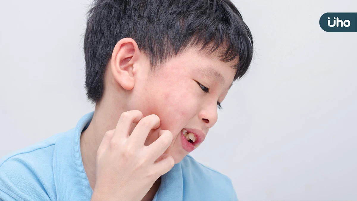 健保放寬口服小分子標靶藥給付至兩年 異位性皮膚炎迎來新曙光