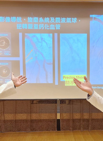 奇美醫院引進AI影像導航、旋磨及震波氣球 逆轉嚴重鈣化血管